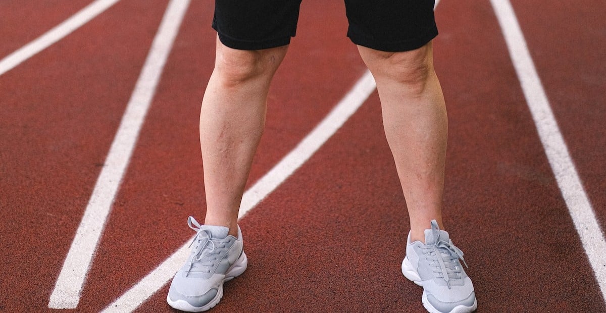 How to drain lactic acid from legs - main image